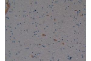 Detection of EPO in Human Brain Tissue using Polyclonal Antibody to Erythropoietin (EPO)