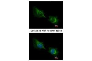 ICC/IF Image Immunofluorescence analysis of methanol-fixed HeLa, using Deltex1, antibody at 1:200 dilution.