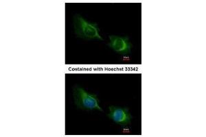 ICC/IF Image Immunofluorescence analysis of methanol-fixed HeLa, using Deltex1, antibody at 1:200 dilution. (Deltex Homolog 1 anticorps  (Center))