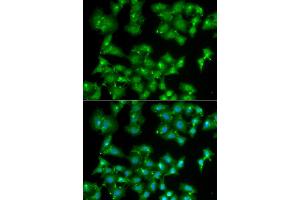Immunofluorescence analysis of A549 cells using ELF3 antibody (ABIN5973778). (ELF3 anticorps)