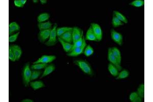 Immunofluorescence staining of HepG2 cells with ABIN7174220 at 1:66, counter-stained with DAPI. (UBIAD1 anticorps  (AA 1-82))