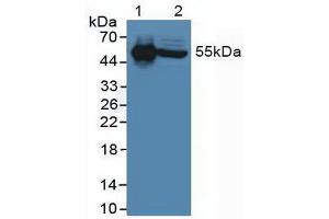 Western blot analysis of (1) Human Serum and (2) Human Liver Tissue. (IL-6 Receptor anticorps  (AA 216-356))