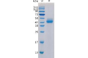 Human TG Protein, N-hFc Tag on SDS-PAGE under reducing condition.