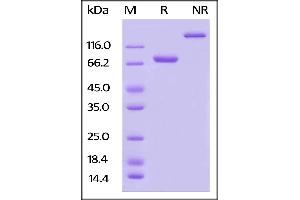 Image no. 1 for Poliovirus Receptor-Related 2 (Herpesvirus Entry Mediator B) (PVRL2) (AA 32-360) (Active) protein (Fc Tag,AVI tag,Biotin) (ABIN5526673) (PVRL2 Protein (AA 32-360) (Fc Tag,AVI tag,Biotin))