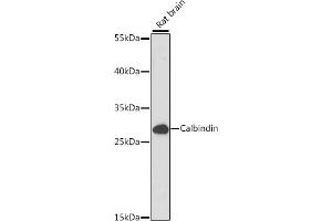 Western blot analysis of extracts of Rat brain, using Calbindin antibody (ABIN7266004) at 1:1000 dilution. (CALB1 anticorps  (AA 1-261))