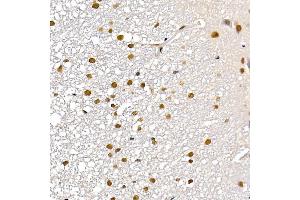 anti-Testis Derived Transcript (3 LIM Domains) (TES) (AA 1-260) antibody