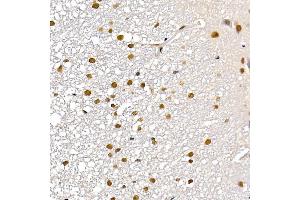 Immunohistochemistry of paraffin-embedded rat kidney using TES Rabbit pAb (ABIN7270772) at dilution of 1:200 (40x lens). (TES anticorps  (AA 1-260))