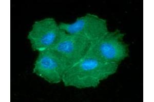 ICC/IF analysis of PGAM2 in Hep3B cells line, stained with DAPI (Blue) for nucleus staining and monoclonal anti-human PGAM2 antibody (1:100) with goat anti-mouse IgG-Alexa fluor 488 conjugate (Green). (PGAM2 anticorps  (AA 1-253))