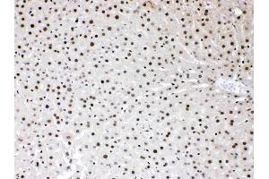 HMGB1 was detected in paraffin-embedded sections of rat liver tissues using rabbit anti- HMGB1 Antigen Affinity purified polyclonal antibody (Catalog # ) at 1 µg/mL. (HMGB1 anticorps  (C-Term))