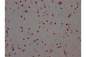 IHC image of ABIN7127324 diluted at 1:100 and staining in paraffin-embedded human brain tissue performed on a Leica BondTM system. (Recombinant ADAR anticorps)