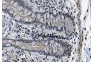 ABIN6266680 at 1/100 staining human colon tissue sections by IHC-P. (ANO9 anticorps  (Internal Region))