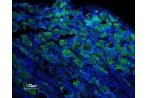 Expression of TRPM8 in rat DRG - Immunohistochemical staining of rat dorsal root ganglion (DRG) frozen sections using Anti-TRPM8 (extracellular) Antibody (ABIN7043837, ABIN7044016 and ABIN7044017), (1:100).