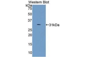 Western blot analysis of recombinant Human COL4a5. (COL4a5 anticorps)