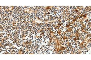Immunohistochemistry of paraffin-embedded Human tonsil tissue using CEACAM21 Polyclonal Antibody at dilution 1:60 (CEACAM21 anticorps)