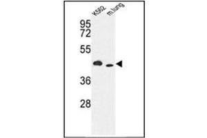 Image no. 1 for anti-Inositol-Trisphosphate 3-Kinase A (ITPKA) (AA 353-382), (C-Term) antibody (ABIN360691) (ITPKA anticorps  (C-Term))