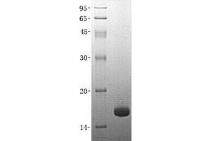 Fatty Acid Binding Protein 5 (Psoriasis-Associated) (FABP5) protein (GST tag)