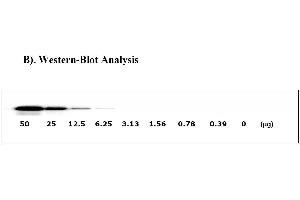 Image no. 4 for Met Proto-Oncogene (MET) ELISA Kit (ABIN625228)