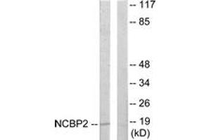 Western blot analysis of extracts from COLO205 cells, using NCBP2 Antibody. (NCBP2 anticorps  (AA 10-59))