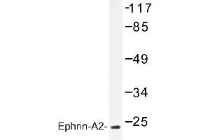 Image no. 1 for anti-Ephrin A2 (EFNA2) antibody (ABIN272138) (Ephrin A2 anticorps)