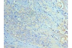 Immunohistochemistry of paraffin-embedded human tonsil tissue using ABIN7151465 at dilution of 1:100 (GCN2 anticorps  (AA 1-300))