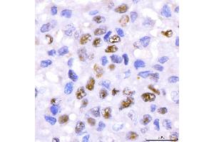 IHC analysis of CRTC3 using anti-CRTC3 antibody (ABIN7599779). (CRTC3 anticorps  (AA 116-619))