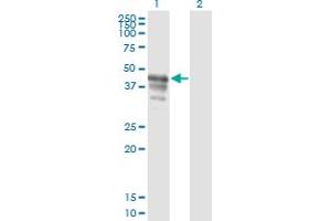 Western Blot analysis of PAIP1 expression in transfected 293T cell line by PAIP1 monoclonal antibody (M04), clone 2D11.