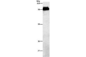 Western Blot analysis of Mouse brain tissue using beta Amyloid Polyclonal Antibody at dilution of 1:1000 (beta Amyloid anticorps)