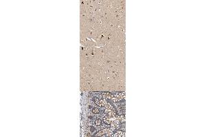 Immunohistochemical staining (Formalin-fixed paraffin-embedded sections) of human cerebral cortex (A, B), human small intestine (C) with MARS polyclonal antibody .