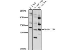TMEM176B Antikörper  (AA 148-208)