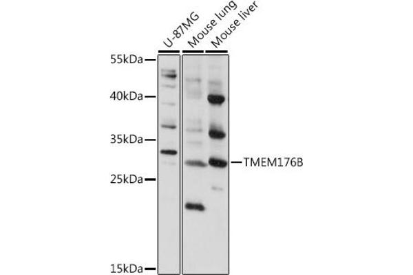 TMEM176B anticorps  (AA 148-208)