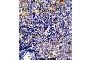 Immunohistochemistry (IHC) image for anti-C-Mer Proto-Oncogene Tyrosine Kinase (MERTK) antibody (ABIN3003537) (MERTK anticorps)