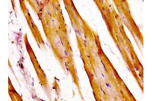 IHC image of ABIN7144797 diluted at 1:400 and staining in paraffin-embedded human skeletal muscle tissue performed on a Leica BondTM system.