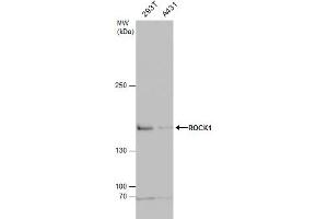 WB Image ROCK1 antibody [N1N2], N-term detects ROCK1 protein by western blot analysis. (ROCK1 anticorps  (N-Term))