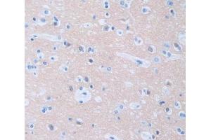 IHC-P analysis of Kidney tissue, with DAB staining. (PPH-3 anticorps  (Regulatory Subunit 1))