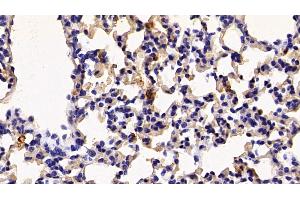 Detection of S100A8 in Mouse Lung Tissue using Polyclonal Antibody to S100 Calcium Binding Protein A8 (S100A8)