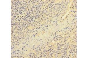 Immunohistochemistry of paraffin-embedded human tonsil tissue using ABIN7151727 at dilution of 1:100 (ESAM anticorps  (AA 30-248))