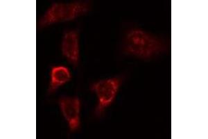 ABIN6275266 staining HeLa cells by IF/ICC. (MYO9B anticorps  (N-Term))