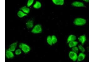 Detection of AST in Hela cells using Polyclonal Antibody to Aspartate Aminotransferase (AST)