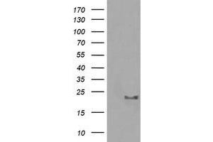 Image no. 1 for anti-HRas proto-oncogene, GTPase (HRAS) antibody (ABIN1498713) (HRAS anticorps)