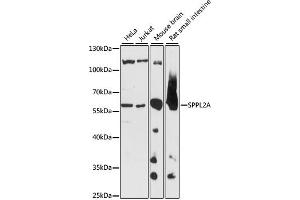 Western blot analysis of extracts of various cell lines, using SPPL2A antibody (ABIN7270297) at 1:1000 dilution.
