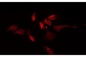 ABIN6267701 staining NIH-3T3 by IF/ICC. (CaMK2 alpha/beta/delta anticorps  (pThr305))