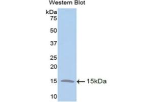 Detection of Recombinant TFF2, Human using Polyclonal Antibody to Trefoil Factor 2 (TFF2)