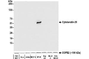Western Blotting (WB) image for anti-Keratin 20 (KRT20) (AA 250-300) antibody (ABIN7453968)