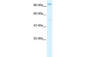 WB Suggested Anti-ZNF409 Antibody Titration:  0.