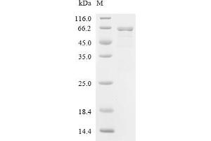 (Tris-Glycine gel) Discontinuous SDS-PAGE (reduced) with 5 % enrichment gel and 15 % separation gel.
