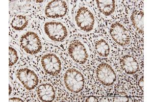 Immunoperoxidase of purified MaxPab antibody to CARF on formalin-fixed paraffin-embedded human colon. (CDKN2AIP anticorps  (AA 1-579))