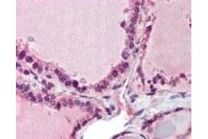 Immunohistochemistry (IHC) image for anti-PAP Associated Domain Containing 7 (PAPD7) (AA 447-462) antibody (ABIN2470063)