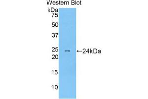 Western blot analysis of the recombinant protein. (MYL12B anticorps  (AA 5-172))