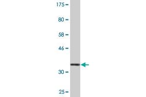 Western Blot detection against Immunogen (35. (TAO Kinase 3 anticorps  (AA 809-898))