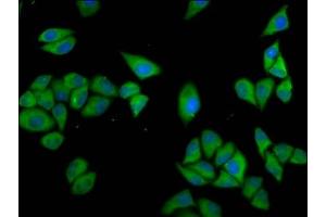 Immunofluorescence staining of Hela cells with ABIN7147569 at 1:133, counter-stained with DAPI. (CLCC1 anticorps  (AA 446-551))